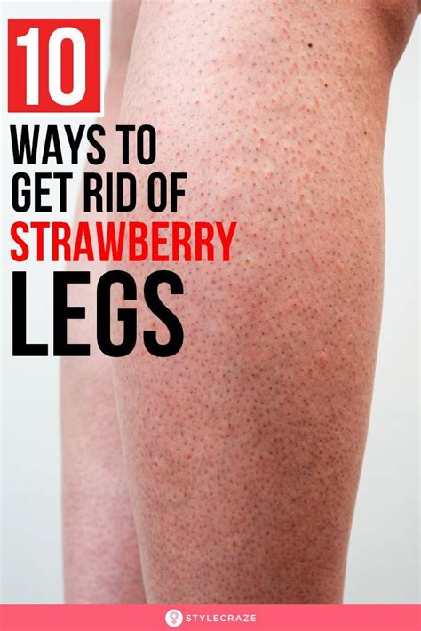 How to get rid of strawberry legs in 5 easy steps – Artofit