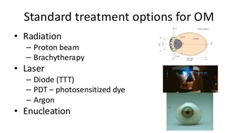 Ocular Melanoma Treatment