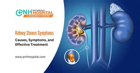 Kidney Stones Symptoms, Causes, Treatment & Diagnosis | PNH Hospital