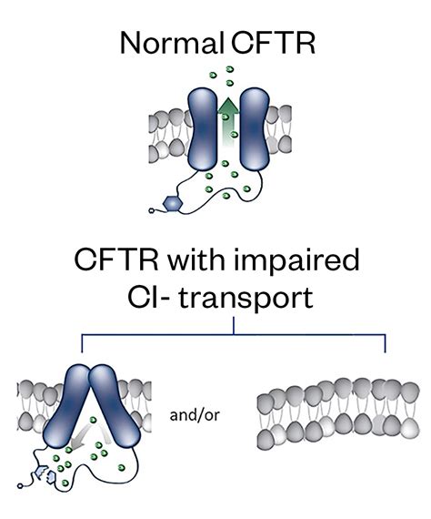 Clinical Impact Of Cftr Modulator Therapy Roll Out The Pharmaceutical