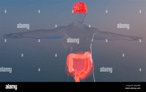 S Ndrome Del Intestino Irritable Sii Gastritis Lcera P Ptica