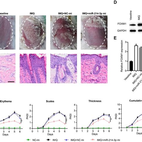 Overexpression Of MiR 214 3p Can Decrease Dermal Cellular Infiltration