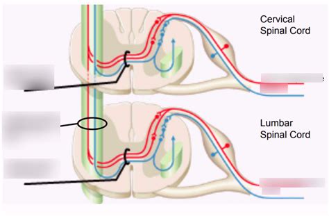 Spinothalamic And Spinoreticular Pathway Lower Half Diagram Quizlet