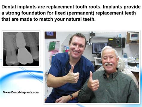 Dental Implant Dr Michael Nugent Dds Pasadena Tx