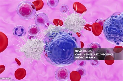 T Cells Attacking Acute Myeloid Leukaemia Cell Illustration High Res