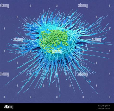 Mycoplasma Composition Coloured Scanning Electron Micrograph Sem Of