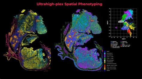 Spatial Phenotyping A Revolutionary Approach To Biomarker Discovery