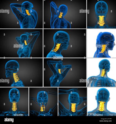 3d Rendering Medical Illustration Of The Cervical Spine Stock Photo Alamy