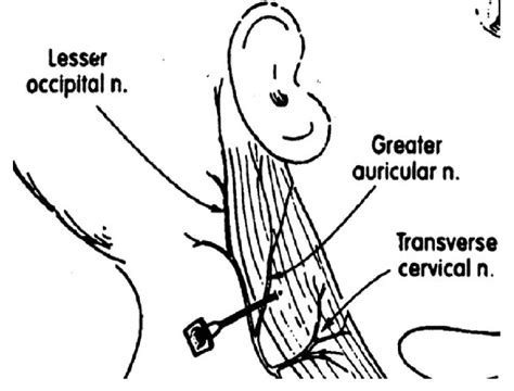 Greater Auricular Nerve. | Download Scientific Diagram