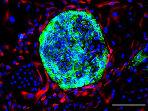 Biologists Create a New Type of Human Cells