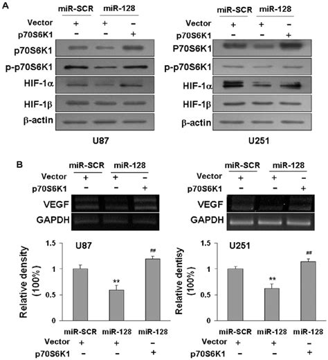 Overexpression Of P70s6k1 Restored The Inhibitory Effects Of Mir 128 In