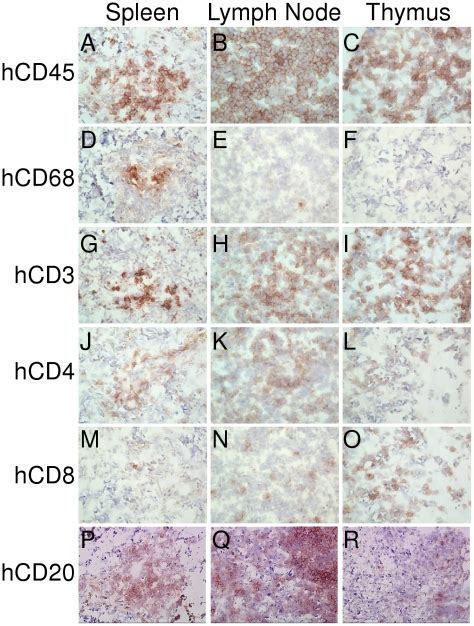 Tissue Sections Of Lymphoid Organs Spleen Lymph Node And Thymus