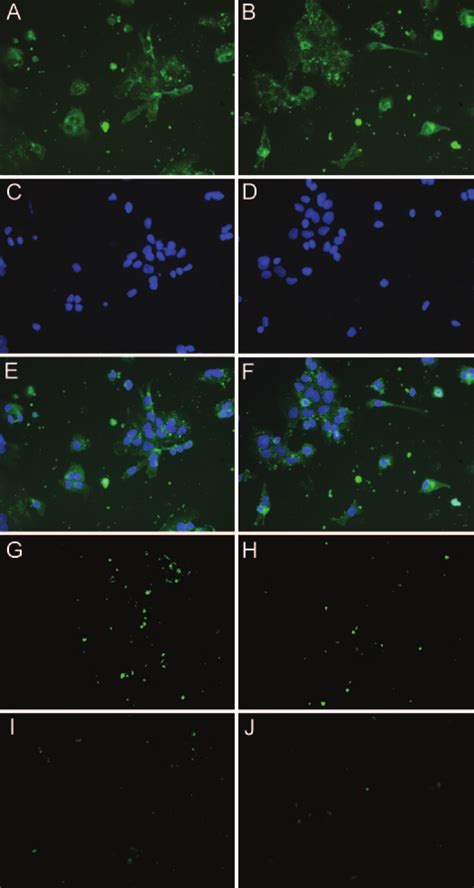 Immunofluorescence Analysis Of Crh Receptors In Cultured Placental