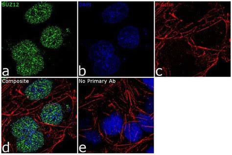 Suz12 Recombinant Rabbit Monoclonal Antibody 7h26l21 Invitrogen™ 100