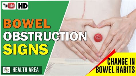 Bowel Obstruction Signs And Symptoms