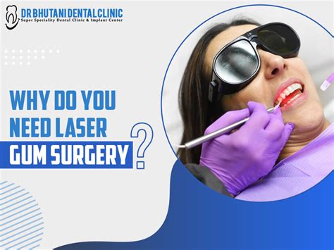 Laser Gum Surgery In Delhi India Laser Gum Surgery Cost