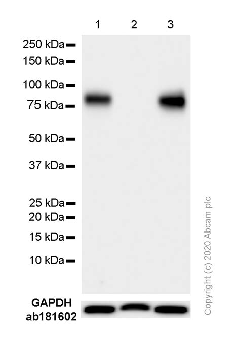 Anti Il Receptor I Il R Antibody Epr Ab Abcam