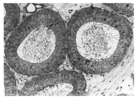 Region 1 In The Epididymis Of A Normal Control Rat With Luminal Sperm