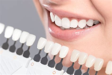 The Best Cosmetic Dental Treatments For Stained Teeth Channo DDS