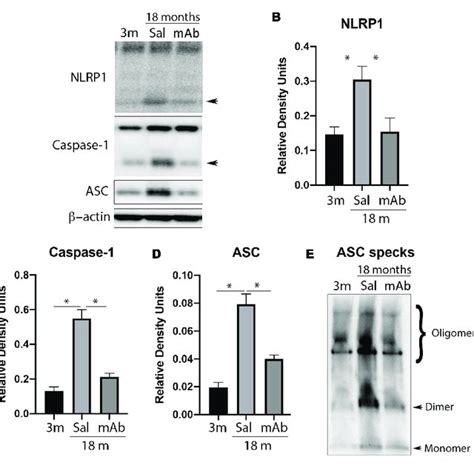 Anti ASC Inhibits NLRP1 Inflammasome Activation In The Cortex Of Aged