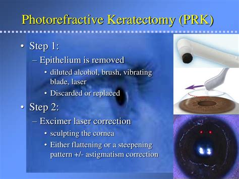 lasik prk potential post op corneal opacities powerpoint
