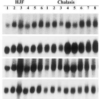 Northern Hybridization The Patterns Of Transcript Expression Of UPA