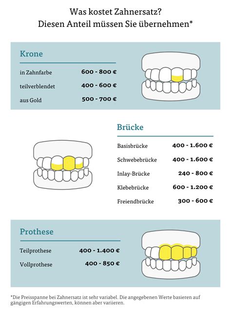 Das Kostet Zahnersatz Arag Zahnratgeber