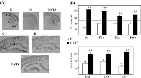 Effect Of Ptu Mmi With Or Without T Treatment On Rc Mrna Level In The