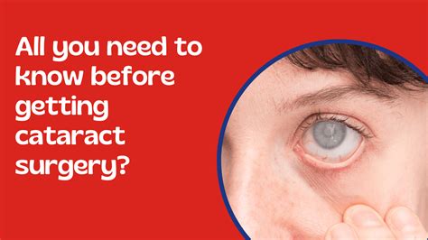 All You Need To Know Before Getting Cataract Surgery Suruchi Eye