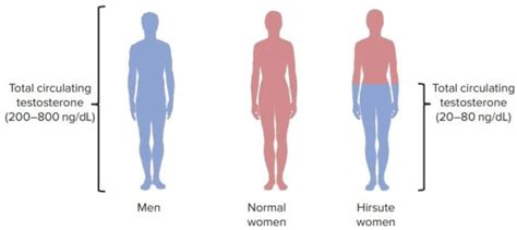 Hirsutism Hypertrichosis — Causes And Treatment Medical Library