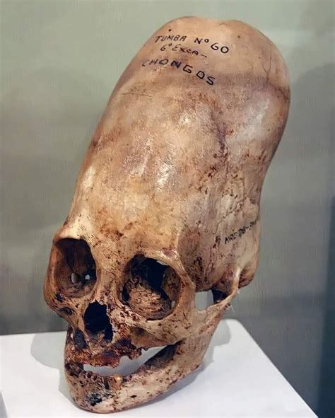 Elongated Skull from the Necropolis Period (200 BC - 200 AD) Near the ...