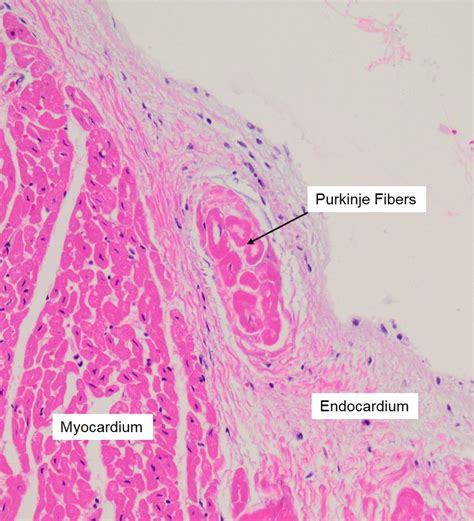 Purkinje Fibers Histology Histology Slides Vet