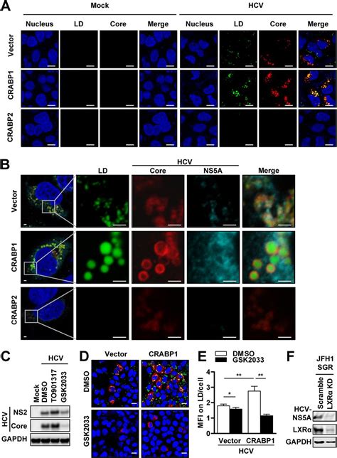 Regulation Of Hepatitis C Virus Infection By Cellular Retinoic Acid