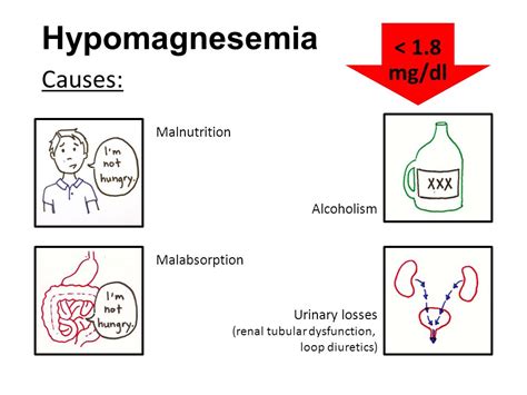 Hypomagnesemia Mnemonic