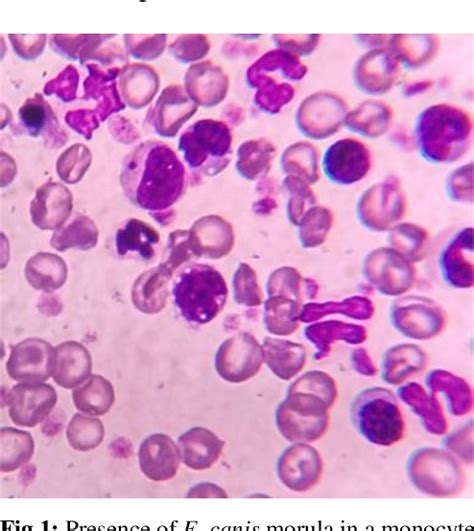 Figure From Spot Diagnosis Of Canine Monocytic Ehrlichiosis Need Of