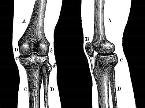 Human Knee Anatomy Drawing Stock Photos, Pictures & Royalty-Free Images ...