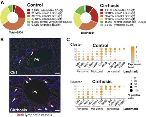 Single Cell Transcriptomics Reveals Zone Specific Alterations Of Liver