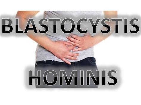 BLASTOCYSTIS HOMINIS - YouTube