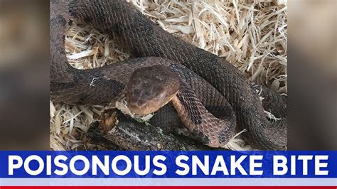 Venomous Copperhead Snake Bites Man In New Jersey Youtube