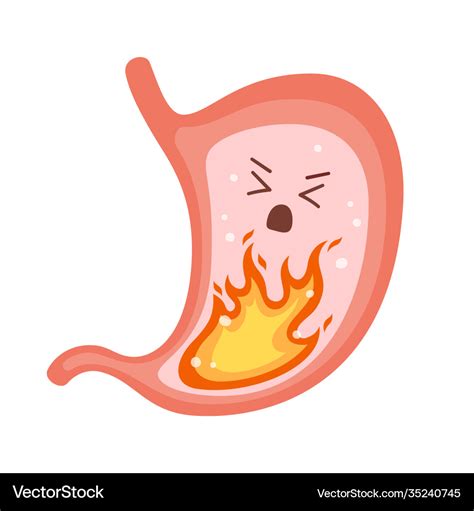 Human Stomach On Fire Heartburn Gastritis Vector Image