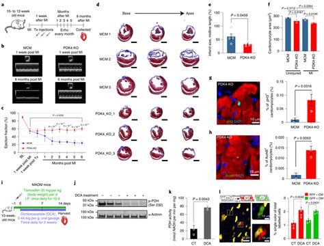 Pdk4 Ko Hearts Show A Higher Lvef Accompanied By A Remarkable Decrease Download Scientific