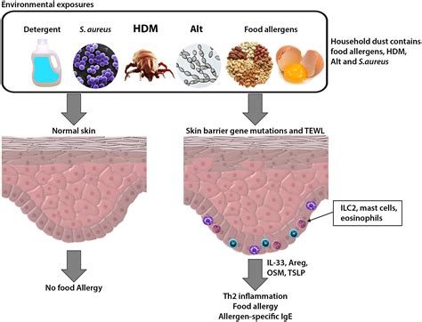 Epithelial Barrier Regulation Antigen Sampling And Food Allergy