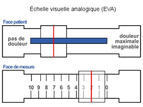 Douleur comparaison des échelles d évaluation de l expérience