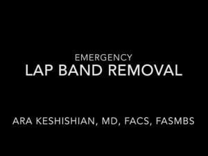 Emergency Lap Band Removal - DSSurgery