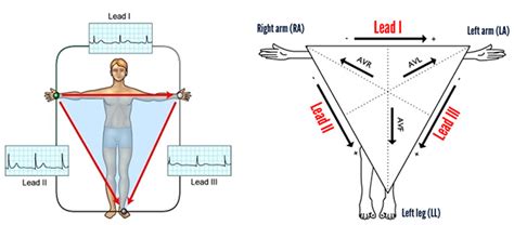 10 Types Of Ecg Devices For Heart Rhythm Monitoring Medicwiz