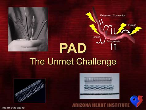 Jet Stream Pathway Device In Peripheral Arterial Disease PPT