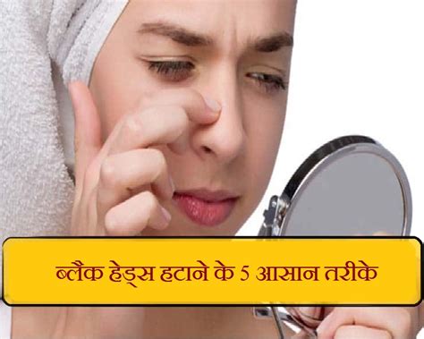 Skin Care Tips नाक पर झाई मार रहे काले दाने क्रीम पाउडर से नहीं इन 5