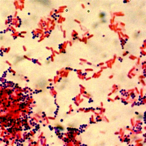 Gram Positive Identification Chart - Best Image Home