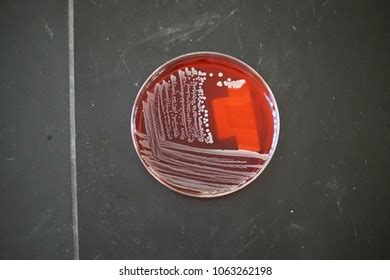 Staphylococcus Aureus Blood Agar Culture Plate写真素材1063262198 Shutterstock