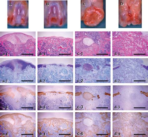 Macroscopic And Microscopic Appearance Of The Cartilage Defects At 4 Download Scientific